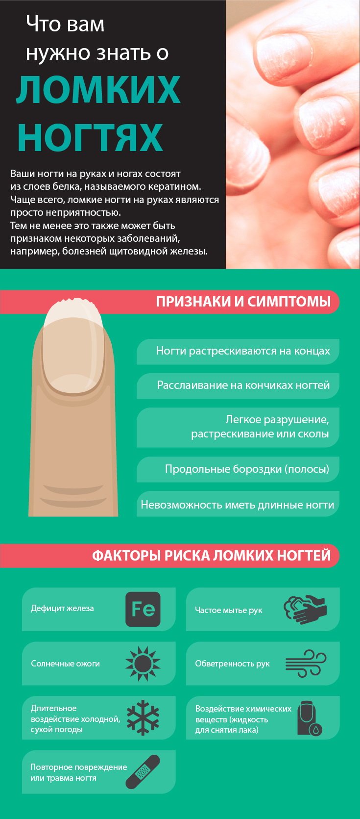 Причины, симптомы и признаки ломких ногтей