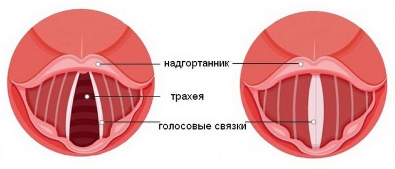 Надгортанник, трахея, голосовые связки