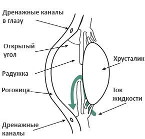 Открытоугольная глаукома