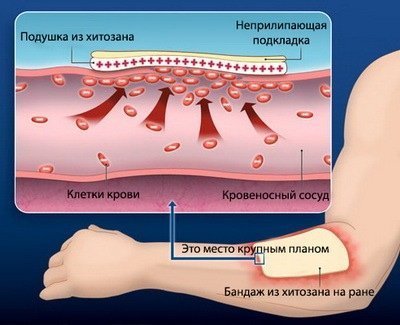 Хитозан для заживления ран