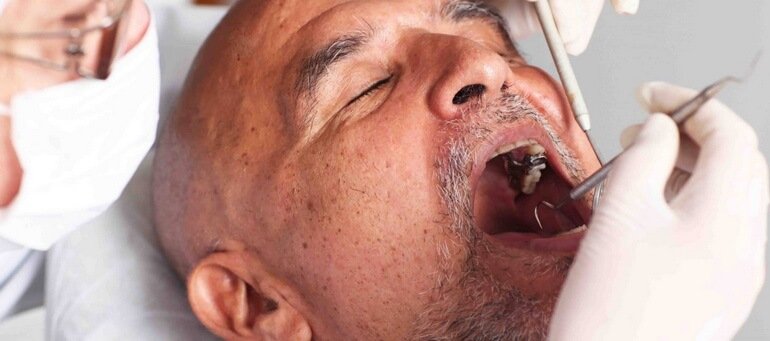 Диагностика рака полости рта