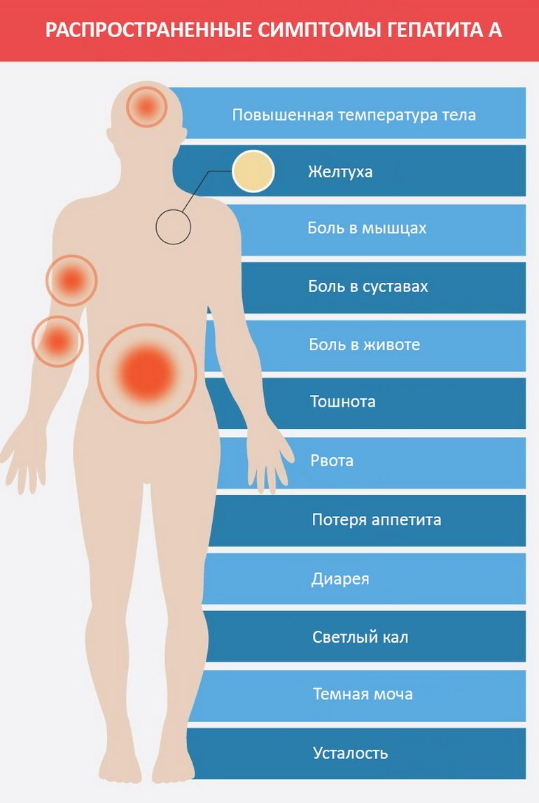 Распространенные симптомы гепатита А