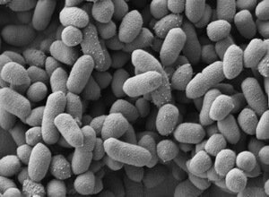 Bacteroides thetaiotaomicron Bacteroides thetaiotaomicron