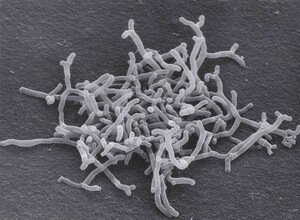 Bifidobacterium Longum Bifidobacterium Longum