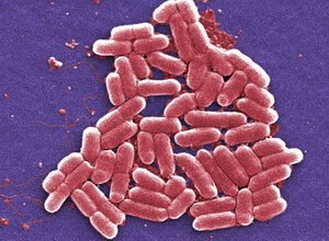 Escherichia Coli Escherichia Coli