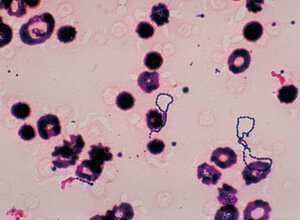 Viridans Streptococci Viridans Streptococci