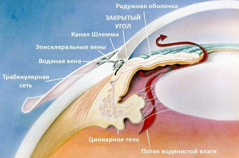 Закрытоугольная глаукома: причины, симптомы, лечение и профилактика